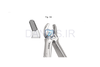 تصویر  فورسپس پرمولر بالا - فالکن