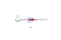 تصویر  رترکتور اندودنتیک - فالکن