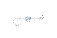 تصویر  کارور نیزه ای - فالکن