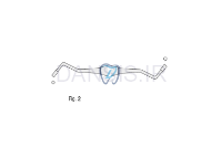 تصویر  کندانسور کامپوزیت - فالکن