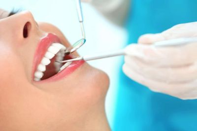 روش کامپوزیت دندان