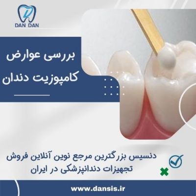بررسی عوارض کامپوزیت دندان