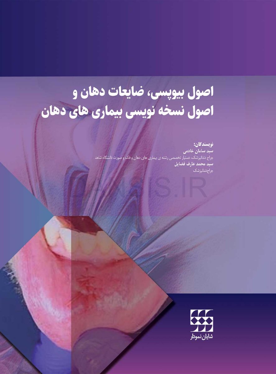 تصویر  اصول بیوپسی، ضایعات دهان و اصول نسخه نویسی بیماری های دهان