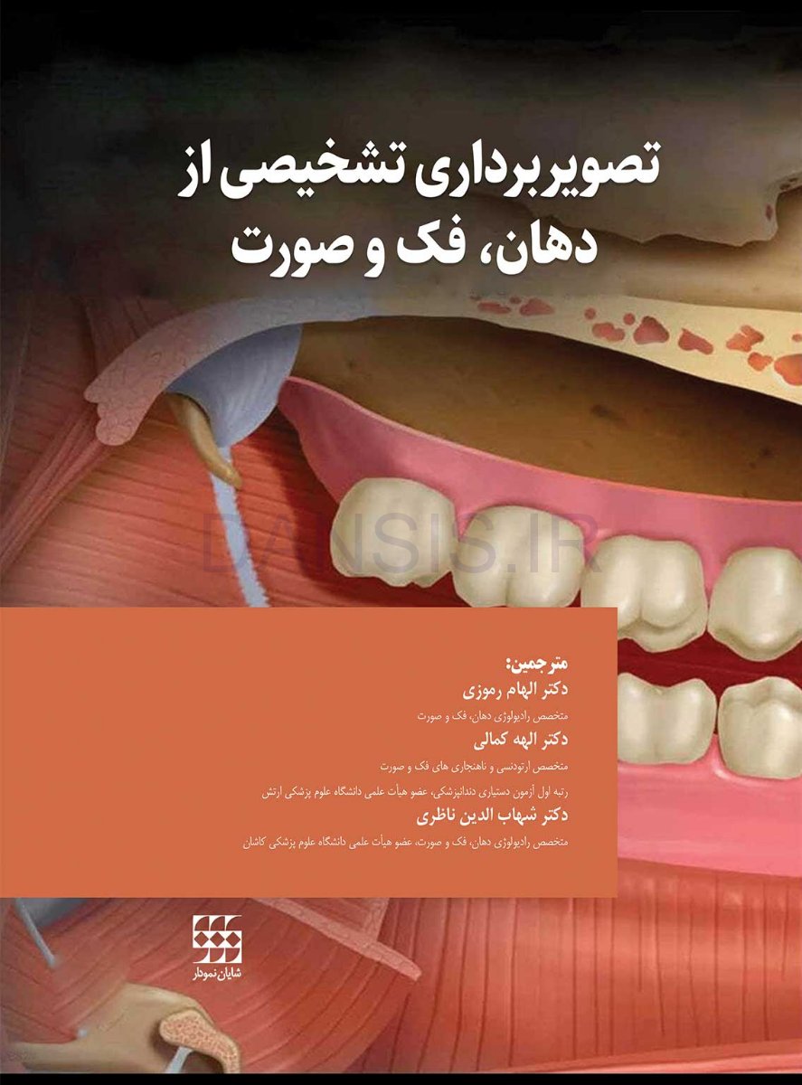 تصویر  تصویربرداری تشخیصی از دهان، فک و صورت