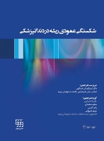 تصویر  شکستگی عمودی ریشه در دندانپزشکی