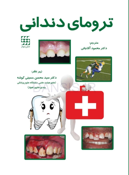 تصویر  ترومای دندانی