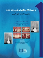 تصویر  ترمیم دندان های درمان ریشه شده (مبانی تکنیک های بالینی)