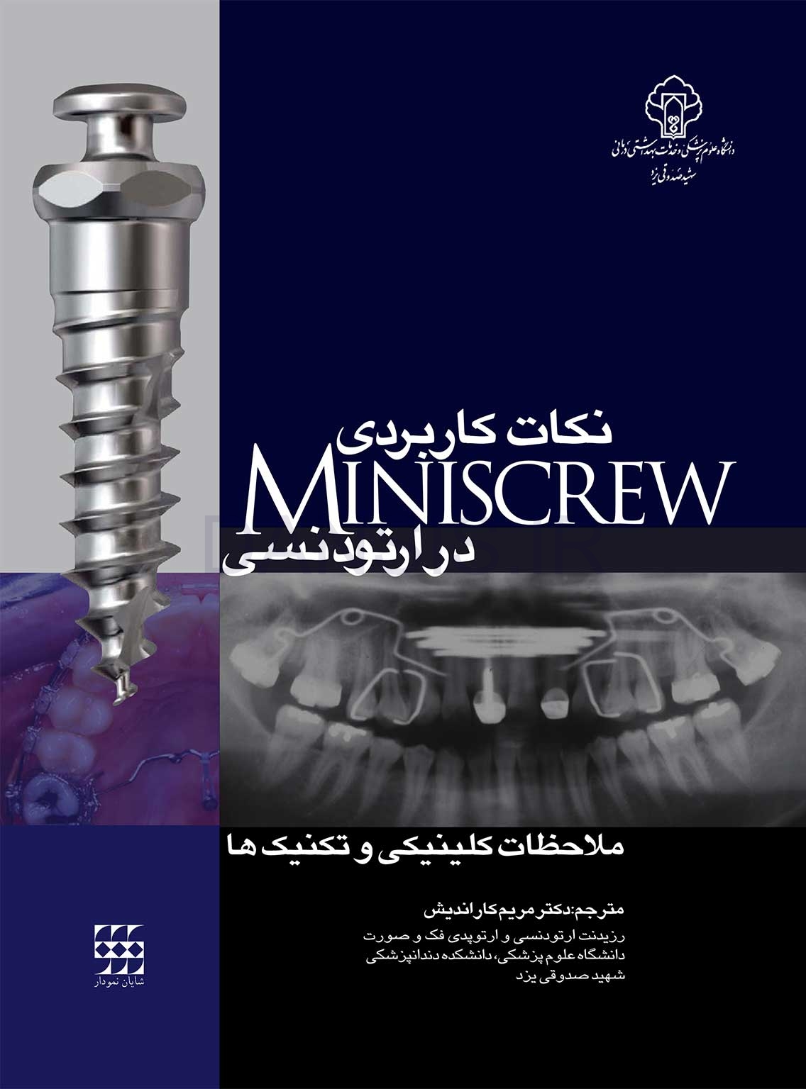 تصویر  نکات کاربردی MINISCREW در ارتودنسی