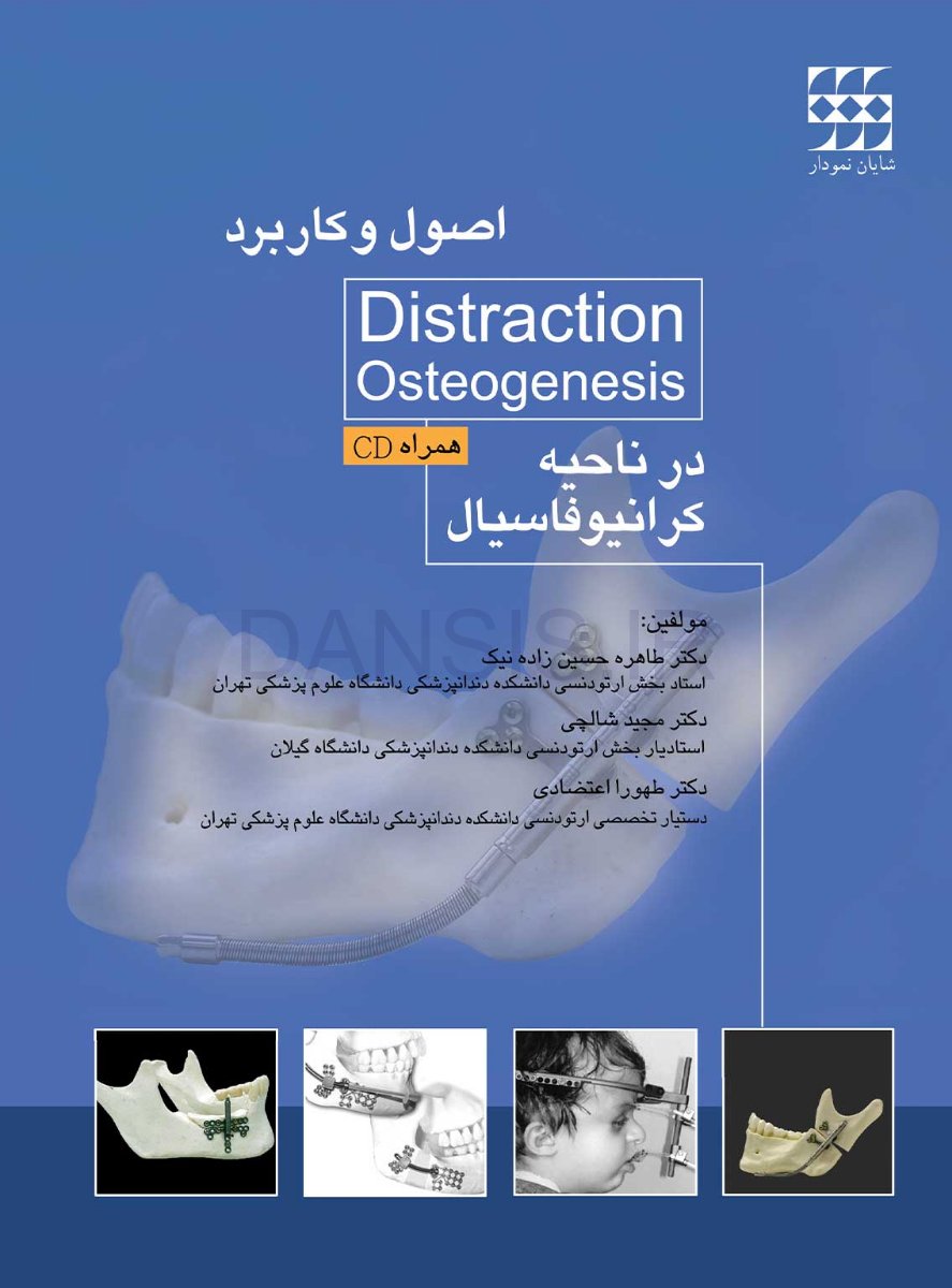 تصویر  اصول و کاربرد Distraction Osteogenesis در ناحیه کرانیوفاسیال همراه با CD