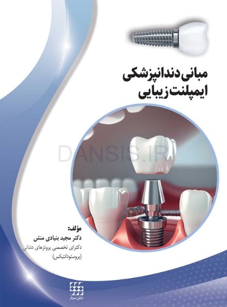 تصویر  مبانی دندانپزشکی ایمپلنت زیبایی