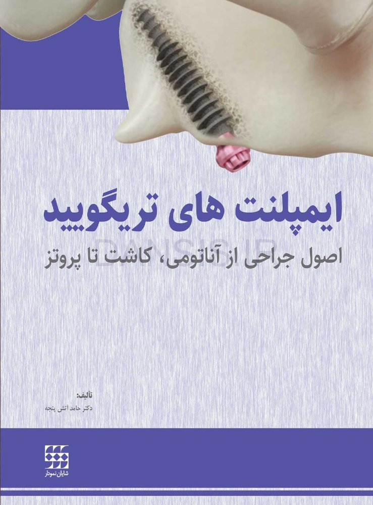 تصویر  ایمپلنت های تریگویید(اصول جراحی از آناتومی، کاشت تا پروتز)