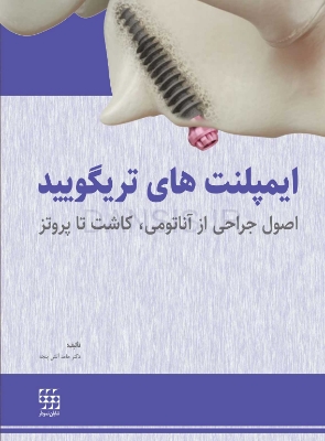تصویر  ایمپلنت های تریگویید(اصول جراحی از آناتومی، کاشت تا پروتز)