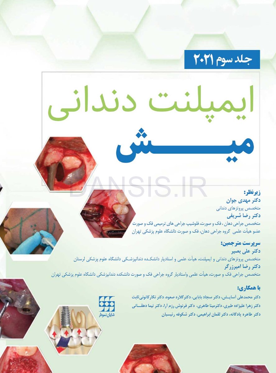 تصویر  ایمپلنت دندانی میش 2021 جلد سوم