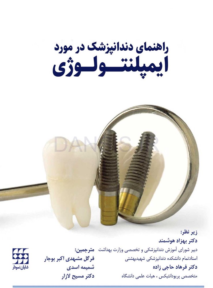 تصویر  راهنمای دندانپزشک درمورد ایمپلنتولوژی