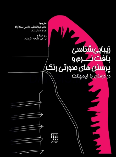 تصویر  زیبایی شناسی بافت نرم و پرسلن های صورتی رنگ در درمان با ایمپلنت