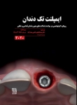 تصویر  ایمپلنت تک دندان 2020