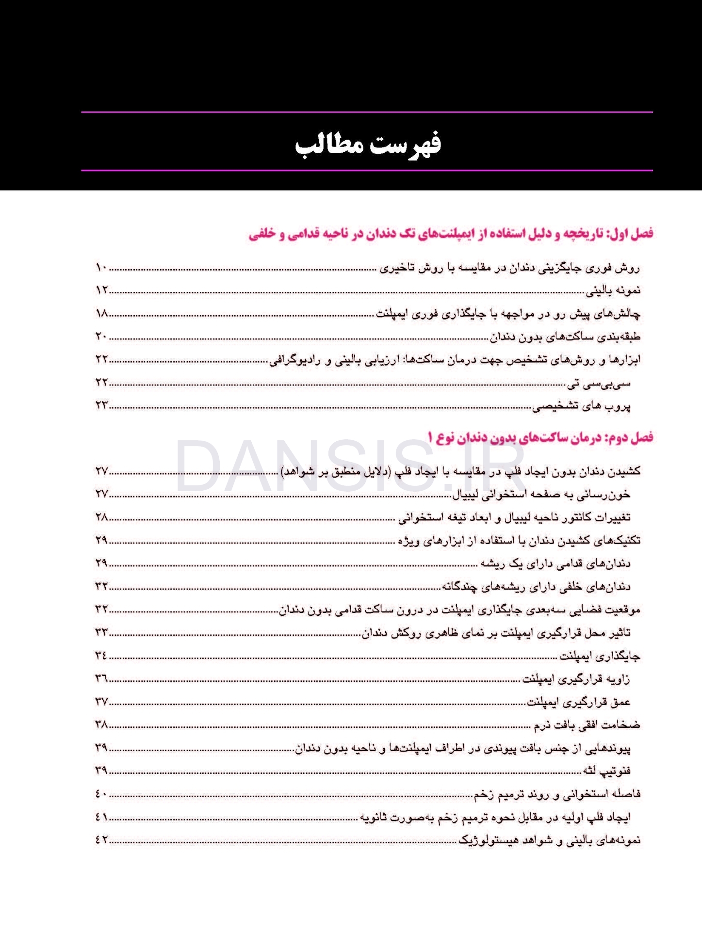 تصویر  ایمپلنت تک دندان 2020
