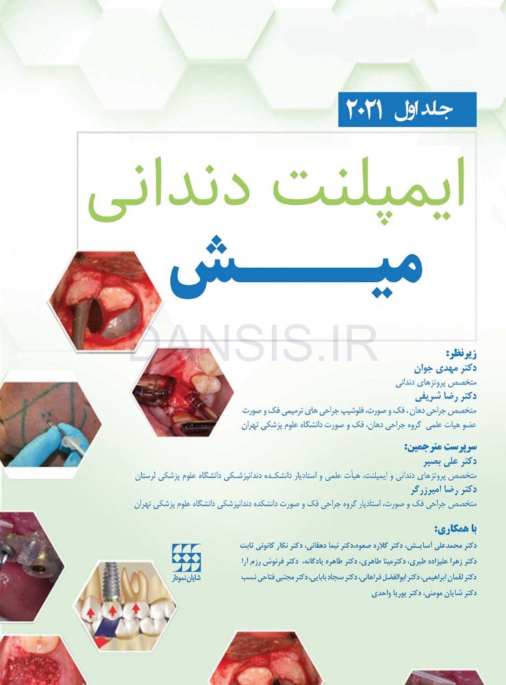 تصویر  ایمپلنت دندانی میش 2021 جلد اول