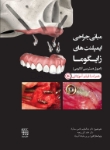 تصویر  مبانی جراحی ایمپلنت های زایگوما (اصول دسترسی آناتومی)