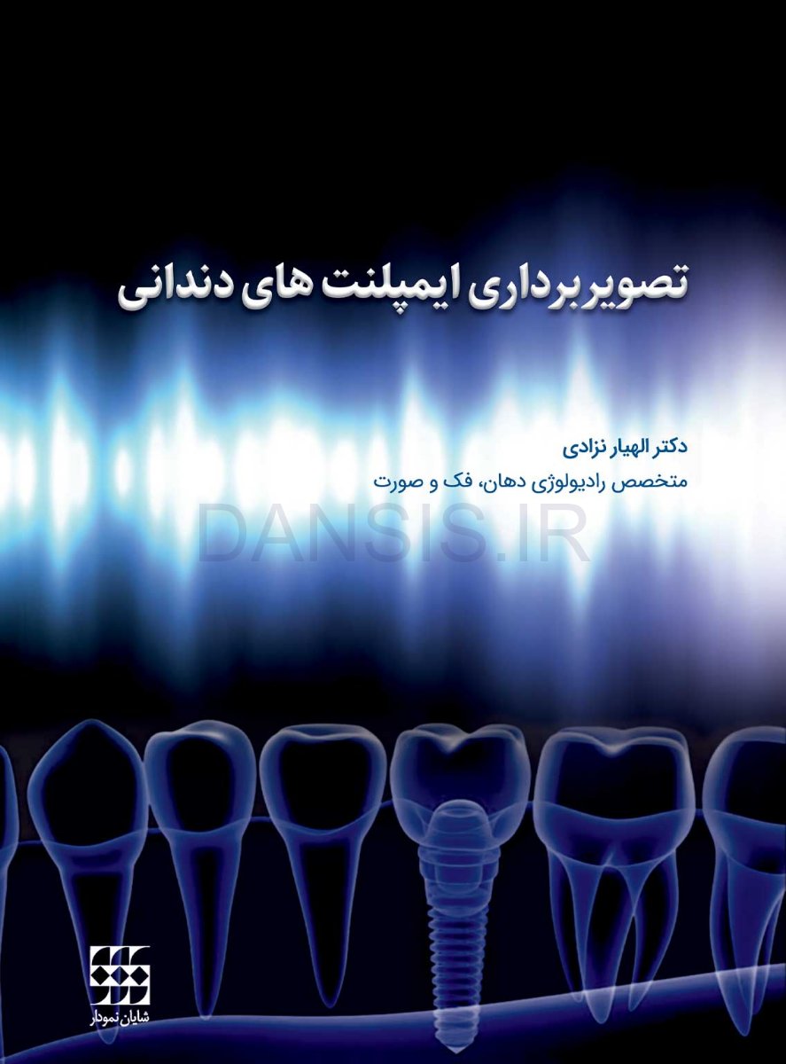تصویر  تصویربرداری ایمپلنت های دندانی