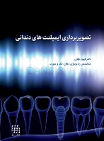تصویر  تصویربرداری ایمپلنت های دندانی