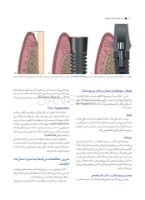 تصویر  راهنمای کلینیکی و لابراتواری اباتمنت در ایمپلنت های دندانی