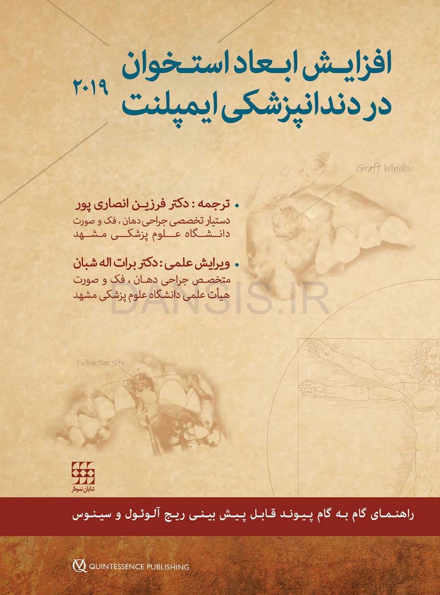 تصویر  افزایش ابعاد استخوان در دندانپزشکی ایمپلنت 2019