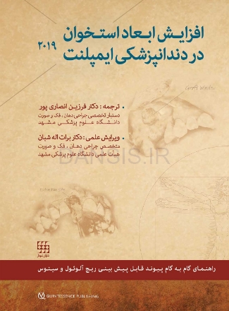 تصویر  افزایش ابعاد استخوان در دندانپزشکی ایمپلنت 2019