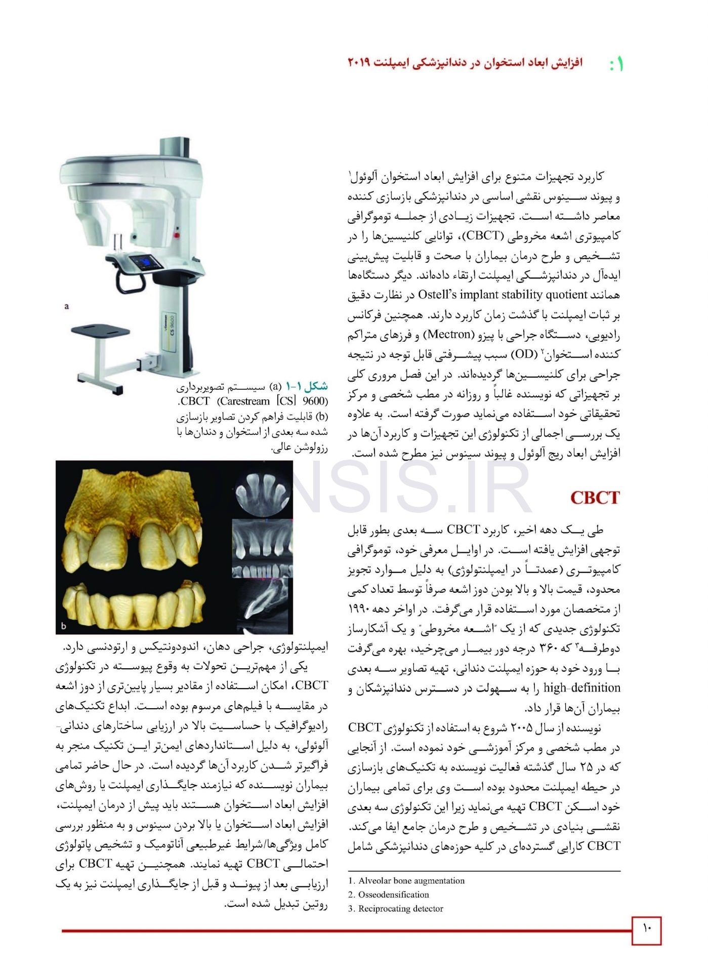 تصویر  افزایش ابعاد استخوان در دندانپزشکی ایمپلنت 2019
