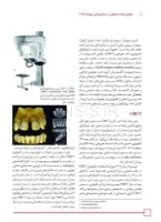 تصویر  افزایش ابعاد استخوان در دندانپزشکی ایمپلنت 2019