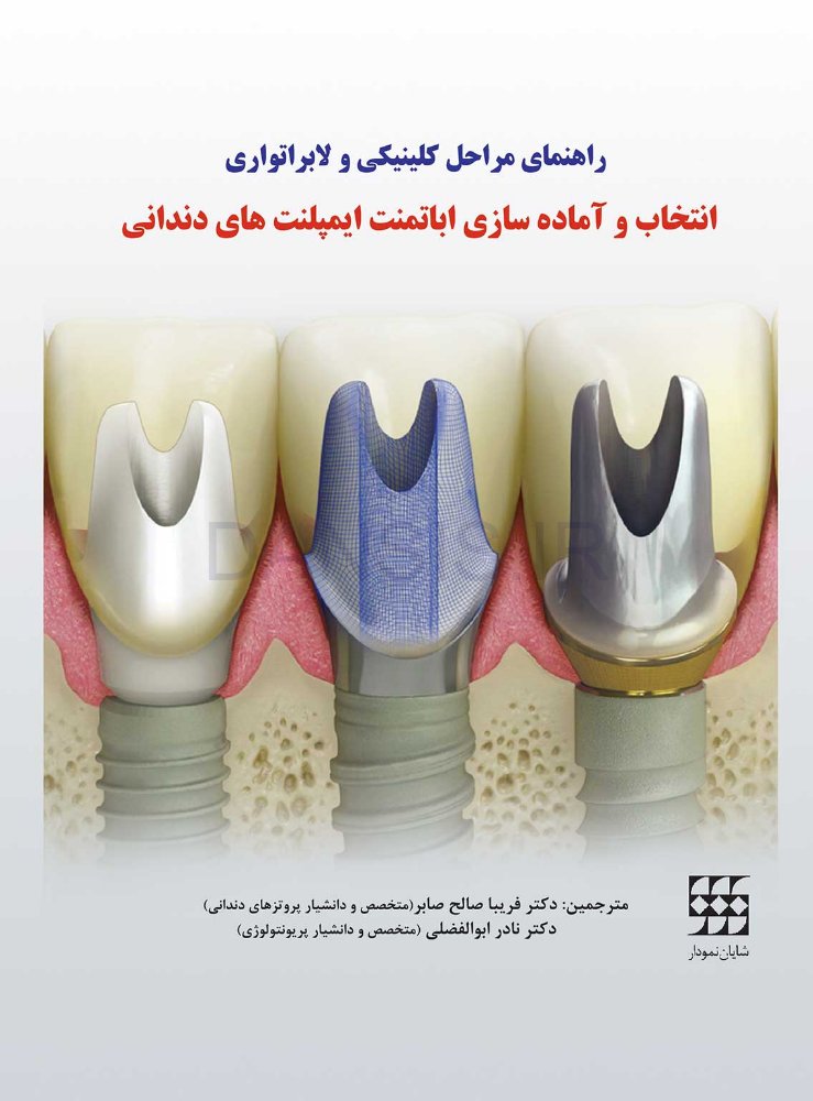 تصویر  راهنمای مراحل کلینیکی و لابراتواری انتخاب و آماده‌سازی اباتمنت ایمپلنت‌های دندانی