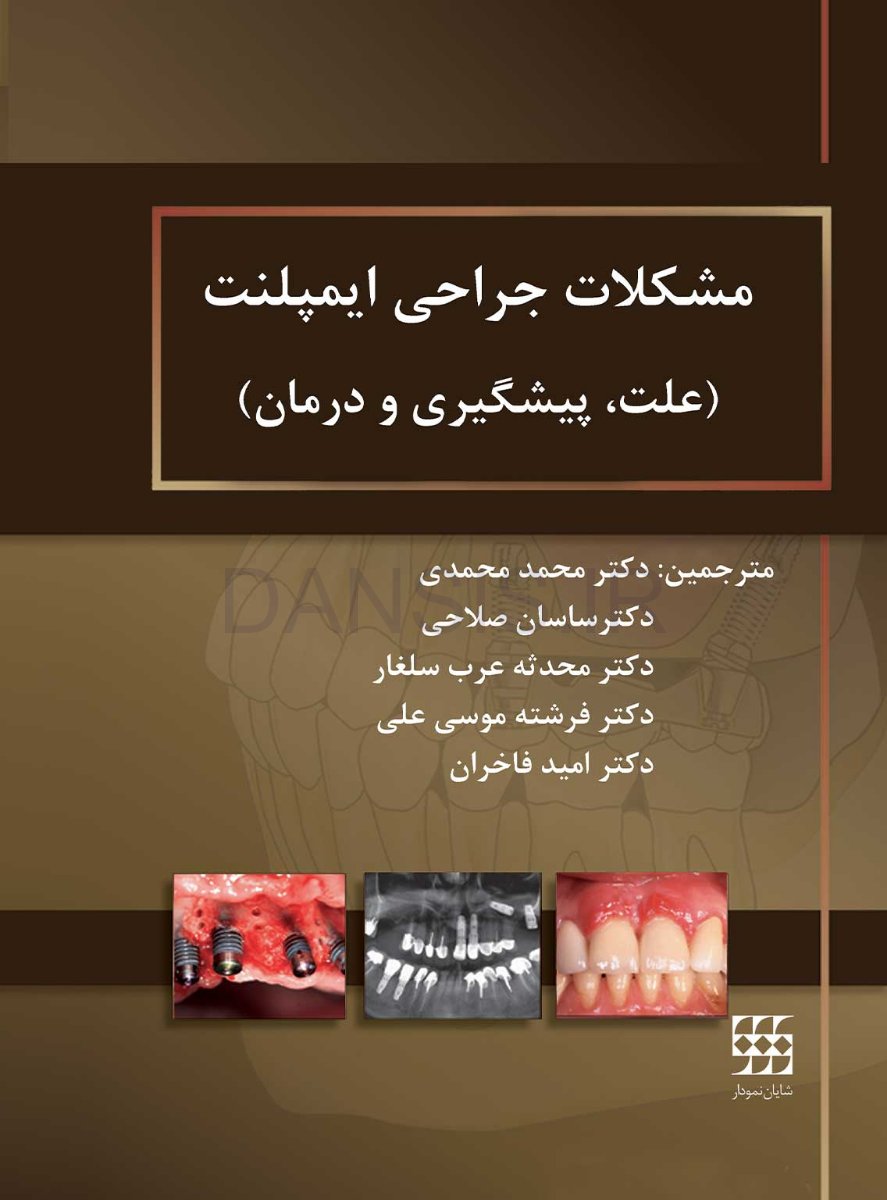 تصویر  مشکلات جراحی ایمپلنت (علت، پیشگیری و درمان)