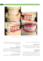 تصویر  پروتز ایمپلنت های دندانی میش 2015 ج 2 (سیاه و سفید)