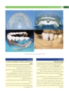 تصویر  پروتز ایمپلنت های دندانی میش 2015 ج 2 (سیاه و سفید)