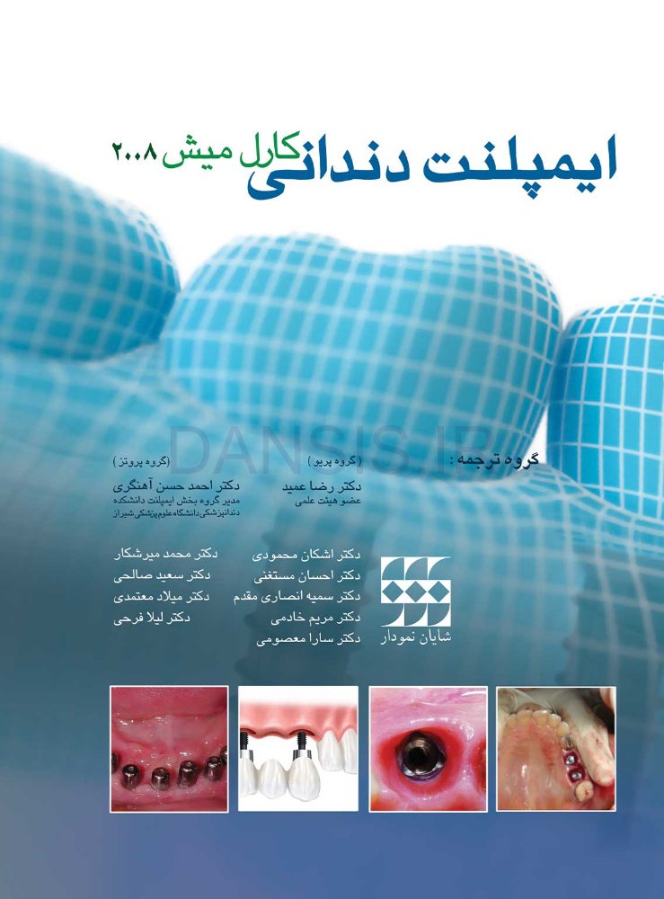 تصویر  ایمپلنت دندانی کارل میش 2008
