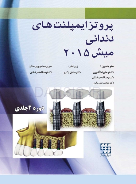 تصویر  پروتز ایمپلنت های دندانی میش 2015 ( گلاسه رنگی دوجلدی همراه با قاب)