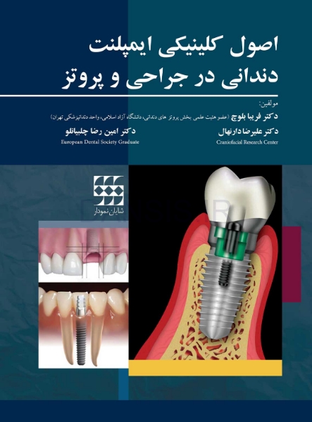 تصویر  اصول کلینیکی ایمپلنت دندانی در جراحی و پروتز