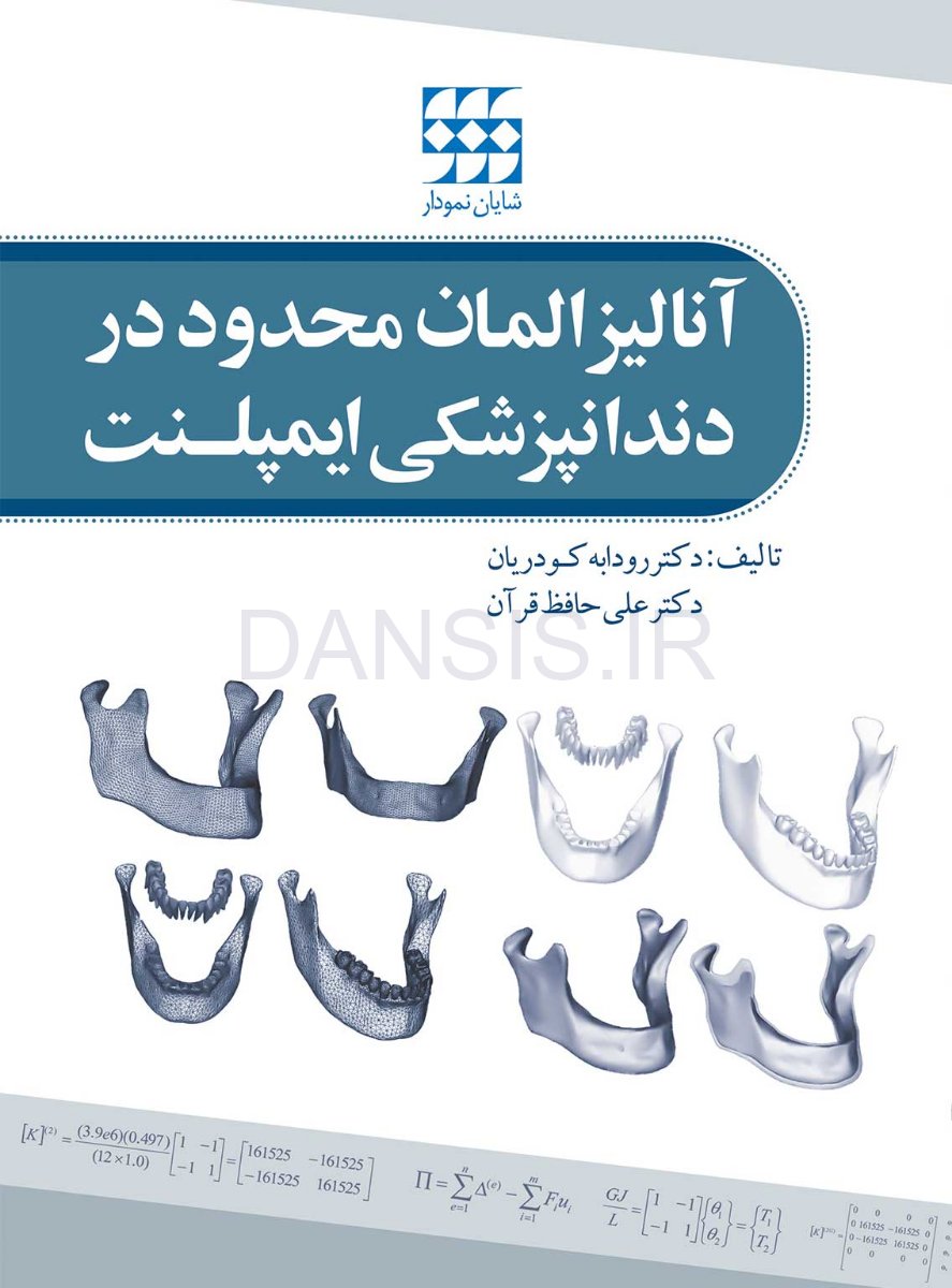 تصویر  آنالیز المان محدود در دندانپزشکی ایمپلنت