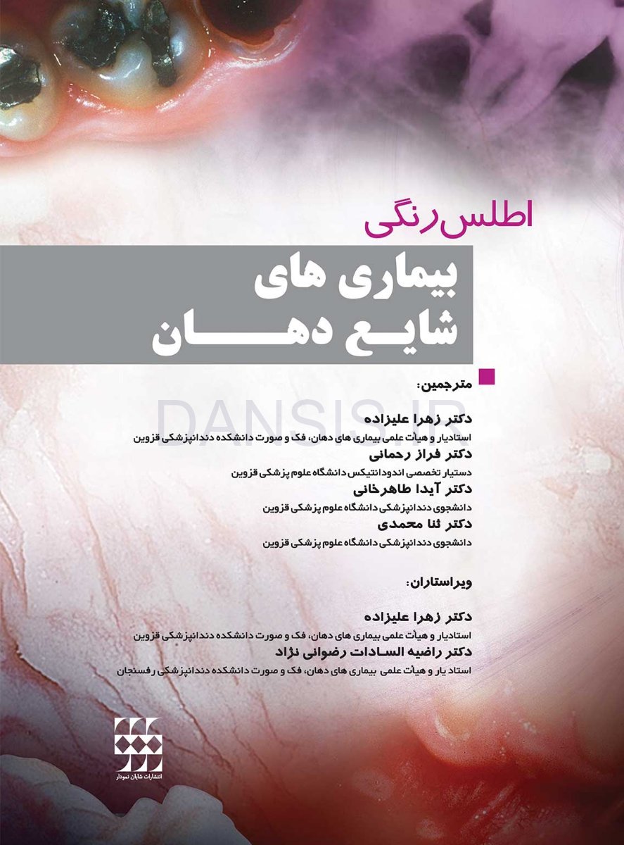 تصویر  اطلس رنگی بیماری های شایع دهان