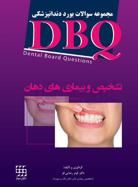 تصویر  DBQ تشخیص و بیماری های دهان (مجموعه سوالات بورد دندانپزشکی)