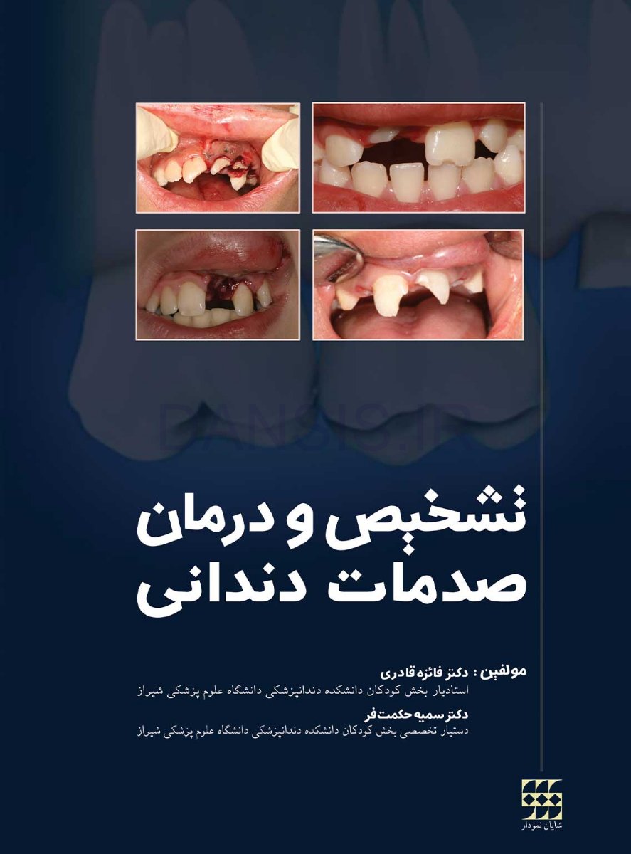 تصویر  تشخیص و درمان صدمات دندانی