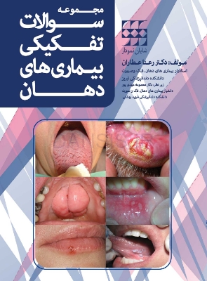 تصویر  مجموعه سوالات تفکیکی بیماری های دهان