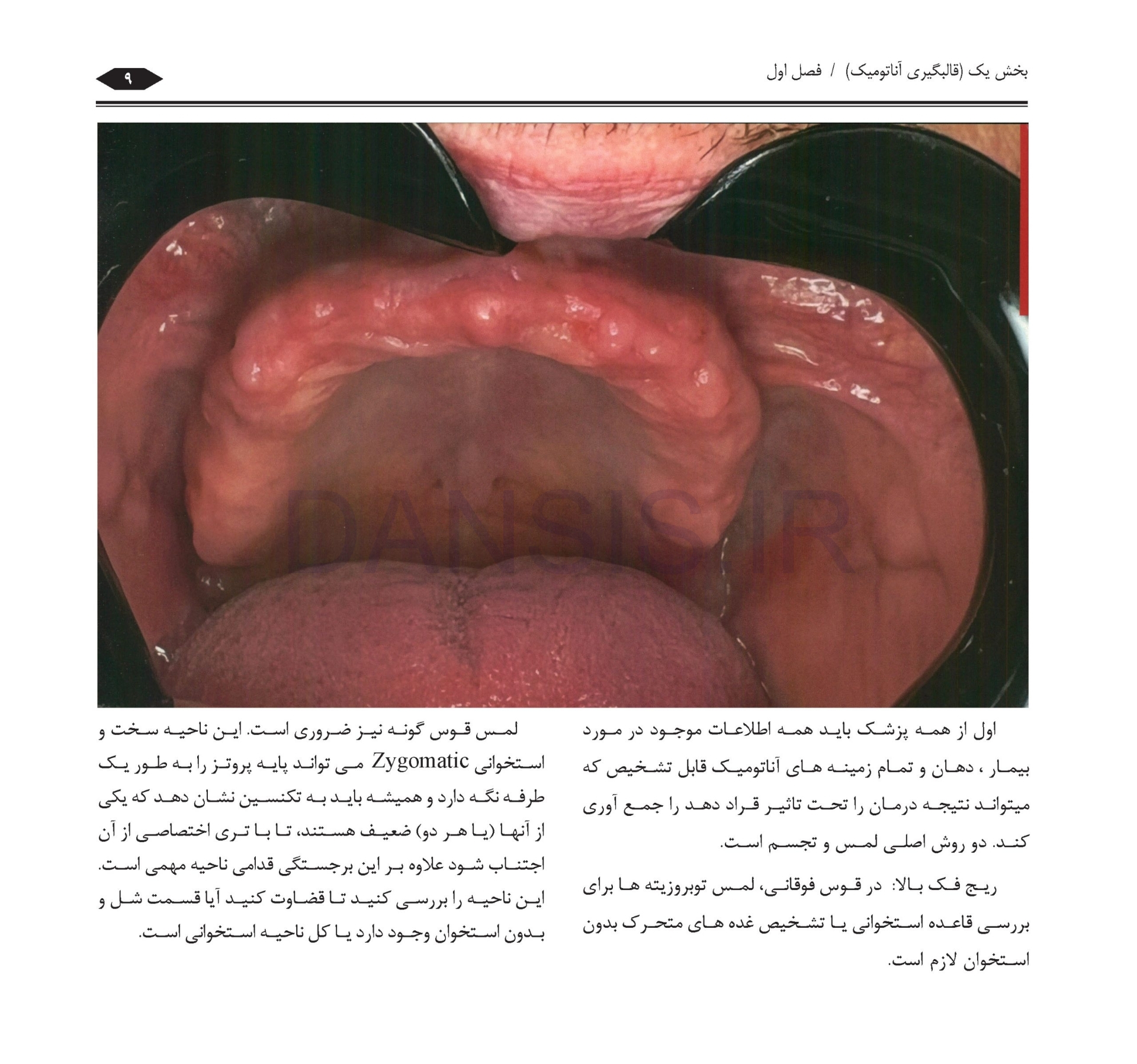 تصویر  گام به گام با BPS