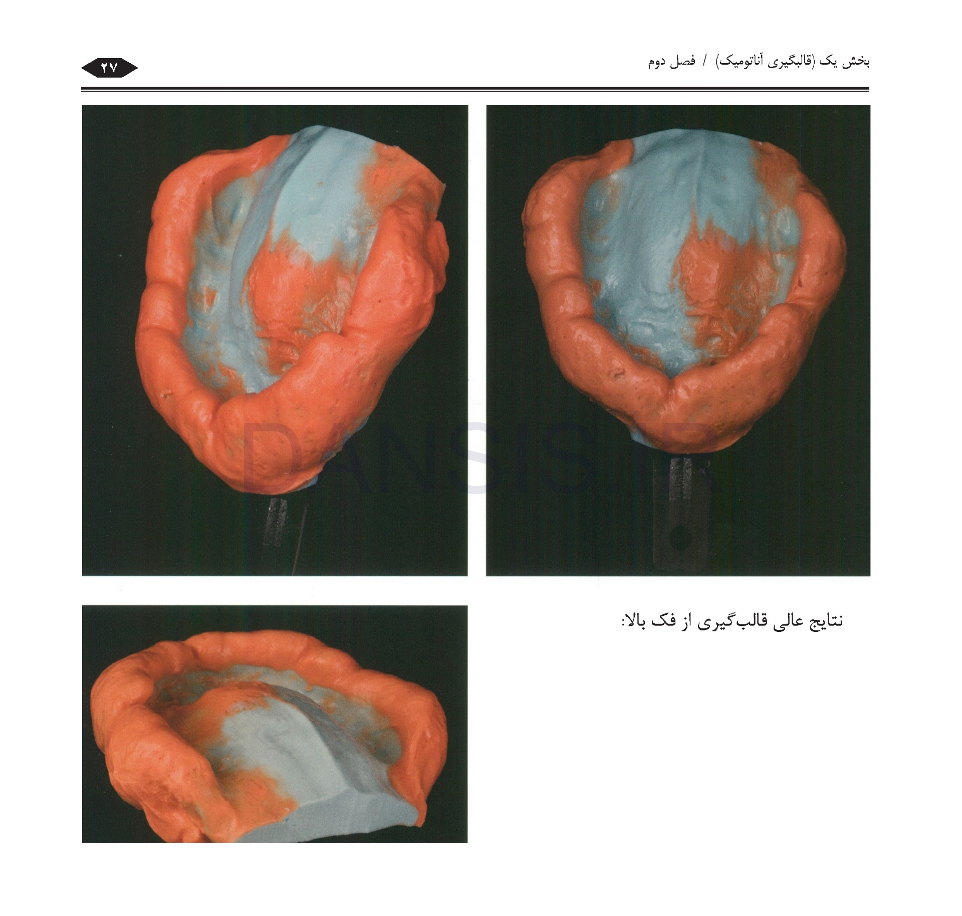 تصویر  گام به گام با BPS