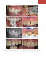 تصویر  اصول نوین در پروتزهای دندانی رزنتال 2023 (جلد دوم)