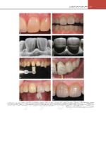 تصویر  اصول نوین در پروتزهای دندانی رزنتال 2023 (جلد دوم)