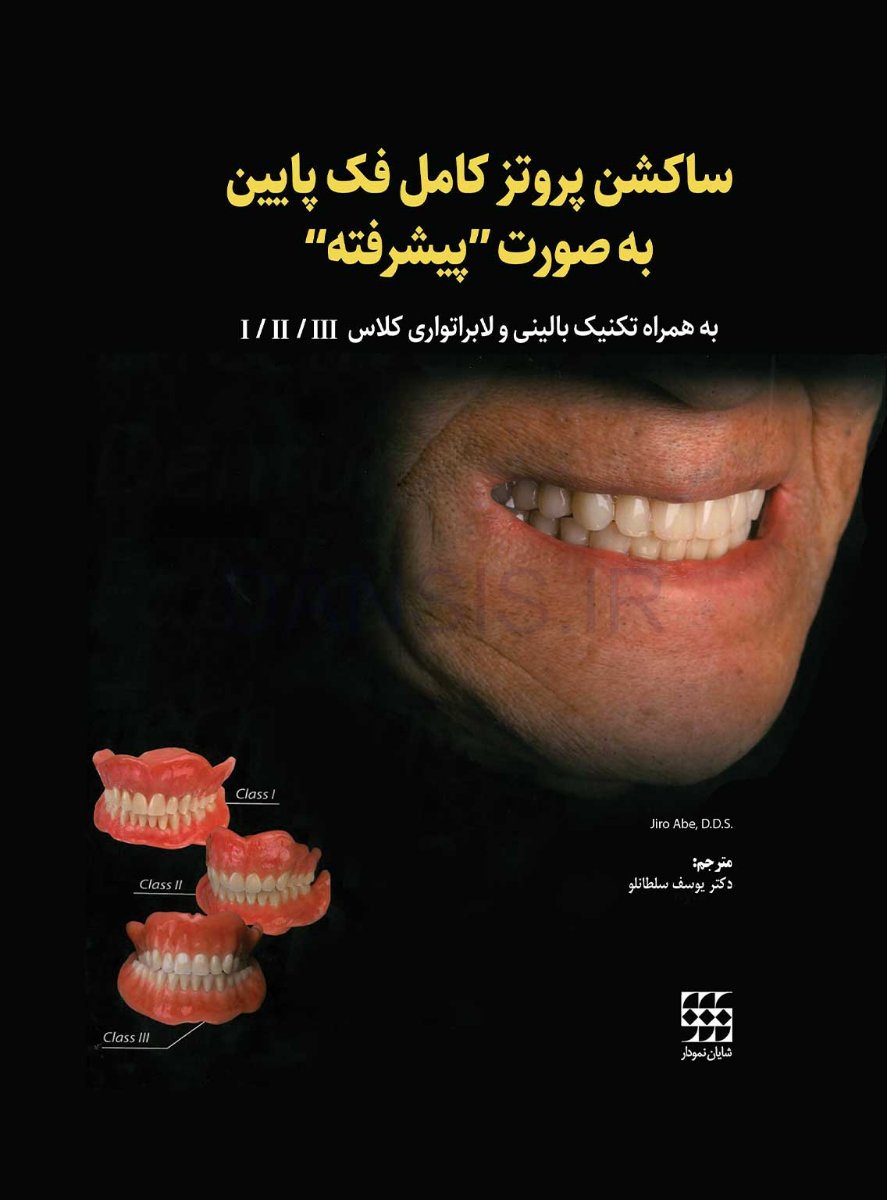 تصویر  ساکشن پروتز کامل فک پایین به صورت “پیشرفته”