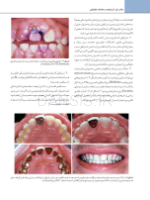 تصویر  اصول نوین در پروتزهای ثابت دندانی رزنتال 2023 (جلد اول)