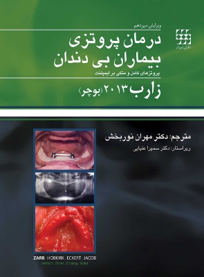 تصویر  درمان پروتزی بیماران بی دندان زارب (بوچر) 2013 همراه با CD اورژینال