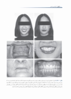 تصویر  درمان پروتزی بیماران بی دندان زارب (بوچر) 2013 همراه با CD اورژینال